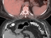 Case 6 (Image 3)