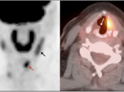 Case 2 (Image 3)