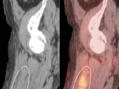 Case 2 (Image 3)