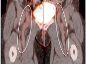 Case 1 (Image 3)