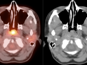Case 1 (Image 3)