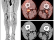 Case 2 (Image 3)