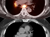 Case 5 (Image 3)