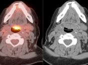 Case 1 (Image 3)