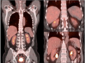 Case 1 (Image 3)