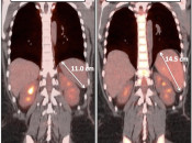 Case 4 (Image 3)