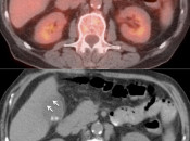 Case 5 (Image 3)