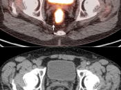 Case 5 (Image 3)