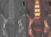 Case 2 (Image 3)