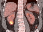 Case 2 (Image 3)
