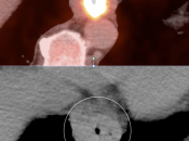 Case 2 (Image 3)