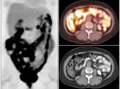 Case 3 (Image 1)
