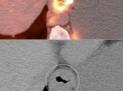 Case 3 (Image 3)