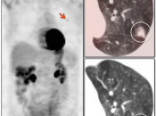Case 11 (Image 3)