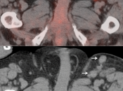 Case 2 (Image 3)