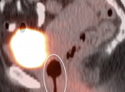 Case 1 (Image 3)