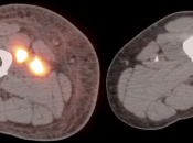 Case 3 (Image 3)