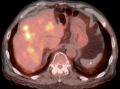 Case 4 (Image 3)