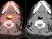 Case 1 (Image 3)