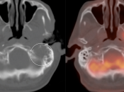 Case 11 (Image 3)