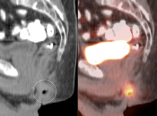 Case 1 (Image 3)