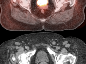 Case 2 (Image 3)
