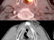 Case 3 (Image 3)