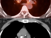 Case 2 (Image 3)