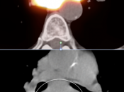 Case 5 (Image 3)