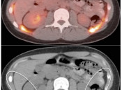 Figure 3 (Image 3) brown fat case 3