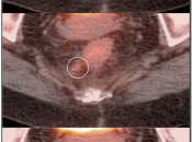 Case 4 (Image 3)
