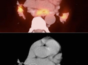 Case 4 (Image 3)