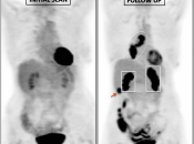 Case 5 (Image 3)