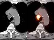 Case 5 (Image 3)