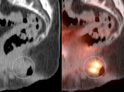 Case 6 (Image 3)