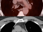 Case 1 (Image 3)