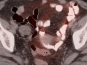 Case 1 (Image 3)