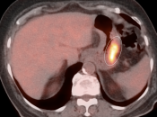 Case 4 (Image 3)
