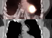 Case 4 (Image 3)