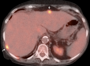 Case 5 (Image 3)