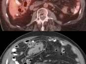 Case 6 (Image 3)