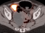 Case 8 (Image 3)