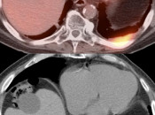 Case 5 (Image 3)