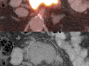 Case 2 (Image 3)