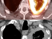 Case 8 (Image 3)