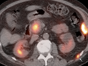 Case 8 (Image 3)