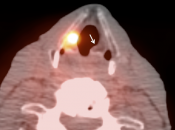 Case 2 (Image 4)