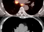 Case 6 (Image 4)