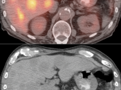 Case 6 (Image 4)