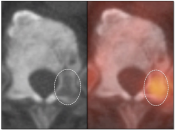Case 4 (Image 4)